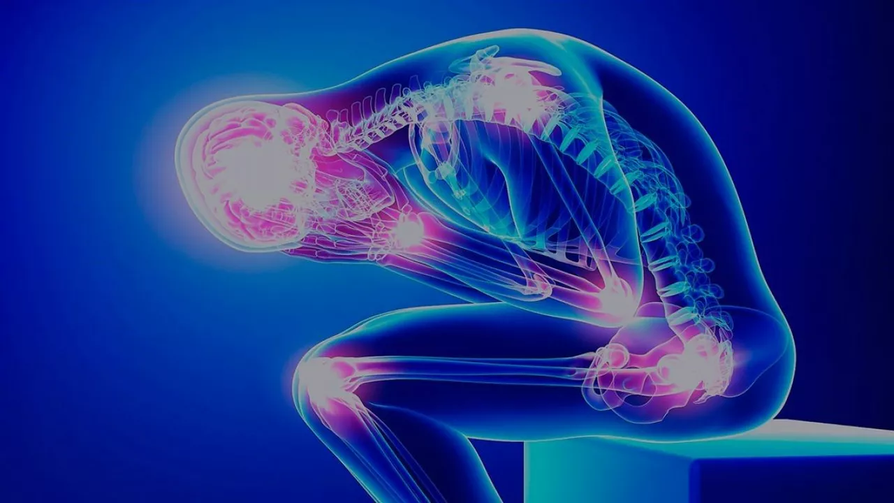 Flurbiprofen for Fibromyalgia: Can It Help with Chronic Pain?